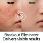 Intensive Cica Repair Cream, Korean Dexpanthenol cream, Restore Skin Barrier, Prevent Acne Breakouts, Ultra-Soothing & Hydrating Care Cream for Sensitive Skin with Madecassoside (1.76oz / 50g) - Image 4