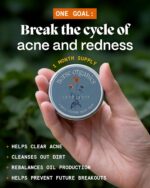 Norse Organics Pimple Stopper Night Balm | Acne Spot Treatment for Redness and Soothing Skin | Natural Bioactive Ingredients Help Treat Blemishes and Breakouts | Dermatologist Approved Skincare | 1 oz - Image 3