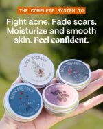 Norse Organics | The Complete System for Pimples 2.0 | 4 Step Skincare Kit with Natural Arctic Herbs | Includes Pimple Stopper Day & Night Balms, Scar Balm, Face Scrub | For All Skin Types (4 pcs) - Image 2